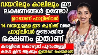 കുട്ടികൾക്ക് വരെ ഫാറ്റിലിവറിനു കാരണം ഈഭക്ഷണമാണ്,ഈ ലക്ഷണം ഉണ്ടോ എന്ന് ഇപ്പോൾ തന്നെ നോക്കു|fatty liver