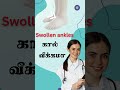 Swollen Ankles? Heart Weakness Warning! கால் வீக்கம் – இதய நோய் அறிகுறி ? | Tamil Bridge
