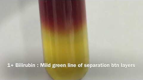 URINE BILIRUBIN TEST