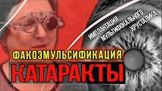 🔴 Факоэмульсификация КАТАРАКТЫ в Москве. Имплантация МУЛЬТИФОКАЛЬНОГО ХРУСТАЛИКА. Лечение катаракты