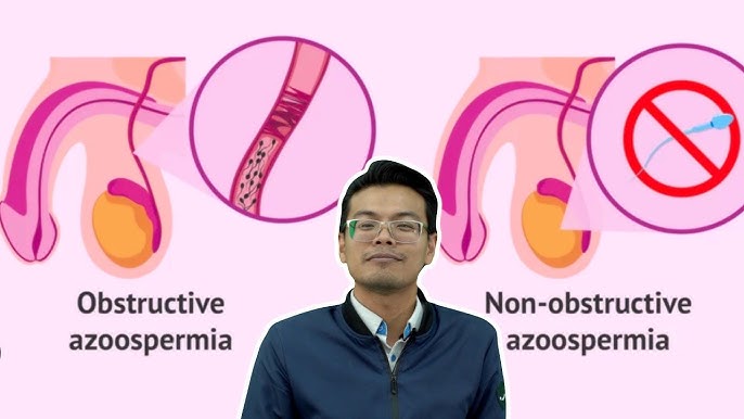 Xolalarning jinsiy kapillyarlari