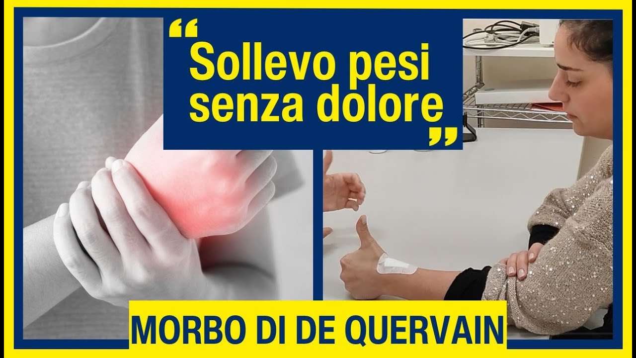 Video testimonianza