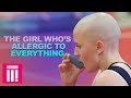 The Girl Who's Allergic To Everything | Living Differently