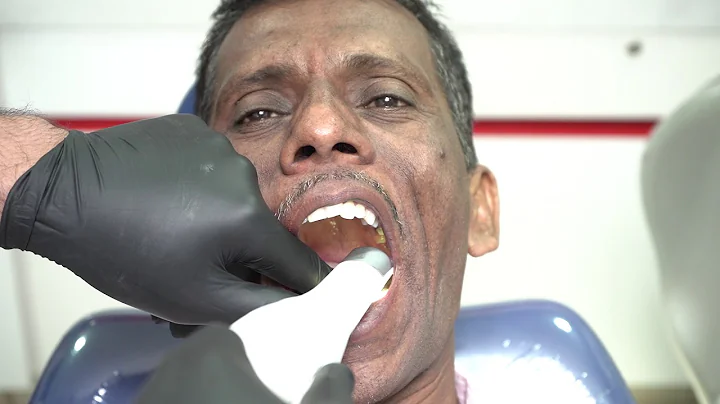 Crown & Bridge workflow with 3Shape