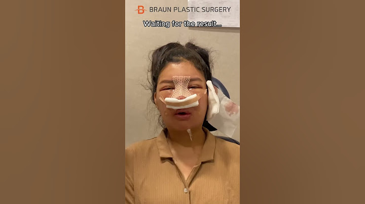 I cried when watching this...😭 #fyp #glowup #facialcontouringsurgery #rhinoplasty #plasticsurgery