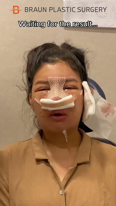 I cried when watching this...😭 #fyp #glowup #facialcontouringsurgery #rhinoplasty #plasticsurgery