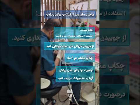 مراقبت های بعدازروکشدندان  دندانپزشکی دندان