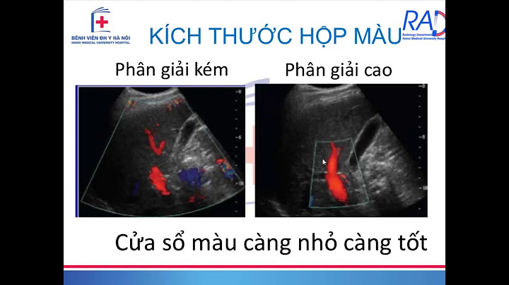 Các lỗi thường gặp của máy siêu âm năm 2024