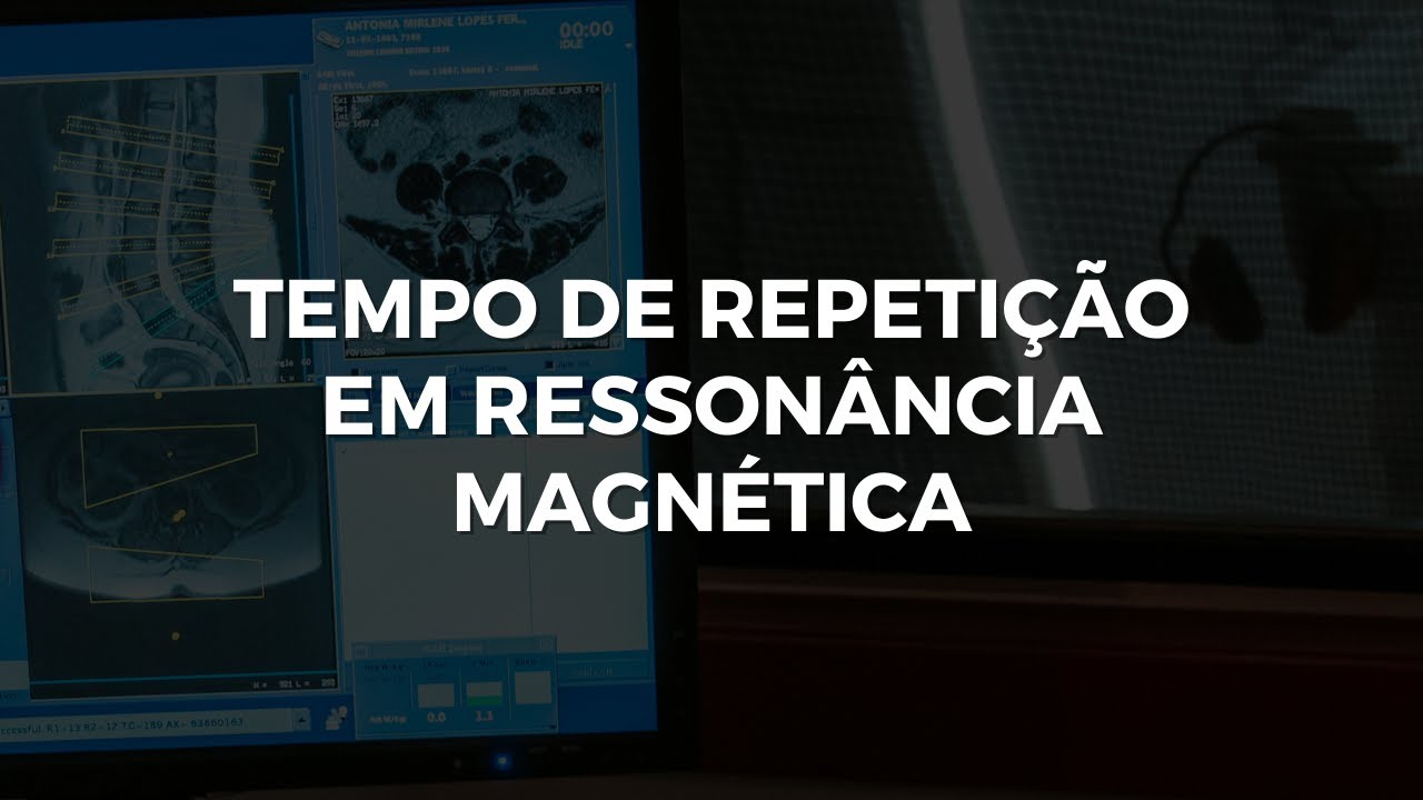 COMO O TEMPO DE REPETIÇÃO (TR) AFETA AS PONDERACOES T1, T2 e DP.