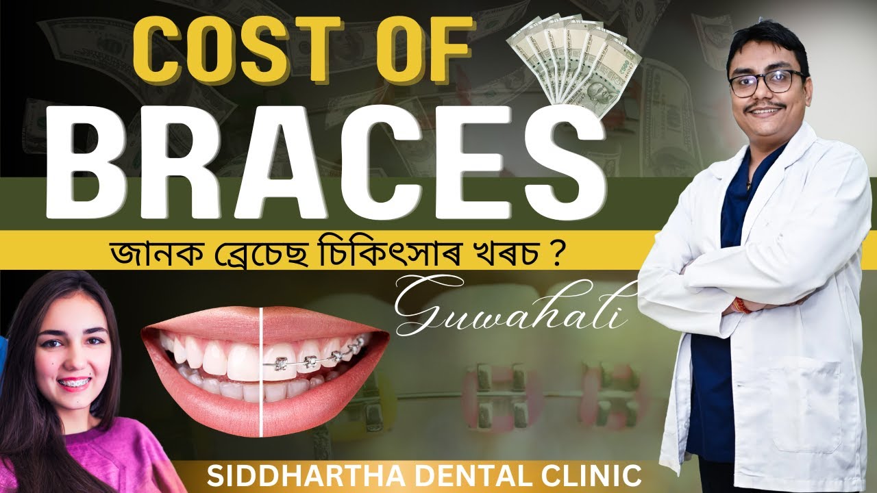 Cost of Braces Treatment in Guwahati Best Dentist in Guwahati