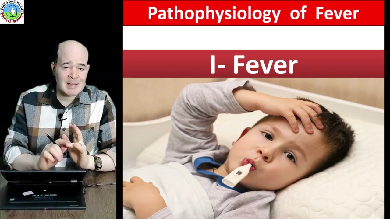 Pathophysiology of Fever - Stages of fever- Basis of managing fever