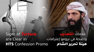 Signs of Torture are Clear in HTS Confession Promo