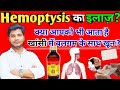 Hemoptysis causes  treatment in hindi            khasi me khoon aana