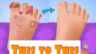 Treatment of fungal infection /nail surgery foot doctor game screenshot 4