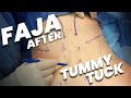 Post-Tummy Tuck Secrets: Compression after Surgery