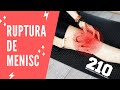 Ruptură de Menisc || Leziune de Menisc || Kinetoterapie Săptâmânile 1-4 Post Operator