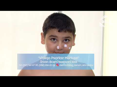 Video: Yenidoğulmuşlar üçün Fototerapiya