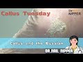 Callus and the Russian #6 - Dr Nail Nipper's Callus Tuesday