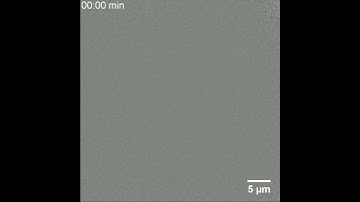 In-situ Transmission Xray Microscopy of a battery