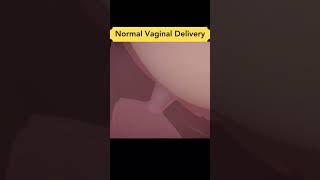 Normal Vaginal Birth #viral #shorts