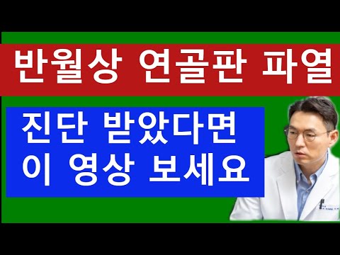 반월상 연골판 파열 진단 받았다면 이 영상 보세요