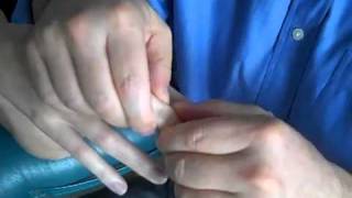 Dr Chikly Demonstrates Fluid Articular Release (FAR) on a Finger Joint