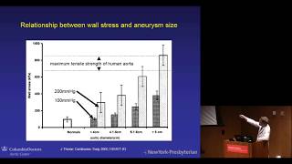 Review of Current Guidelines for Thoracic Aortic Aneurysm  - Craig R Smith , MD