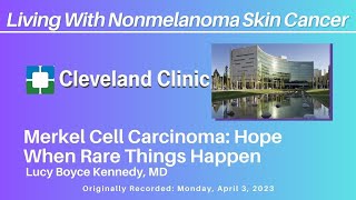2. Merkel Cell Carcinoma: Hope When Rare Things Happen