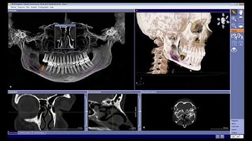 Features of 3D visualization