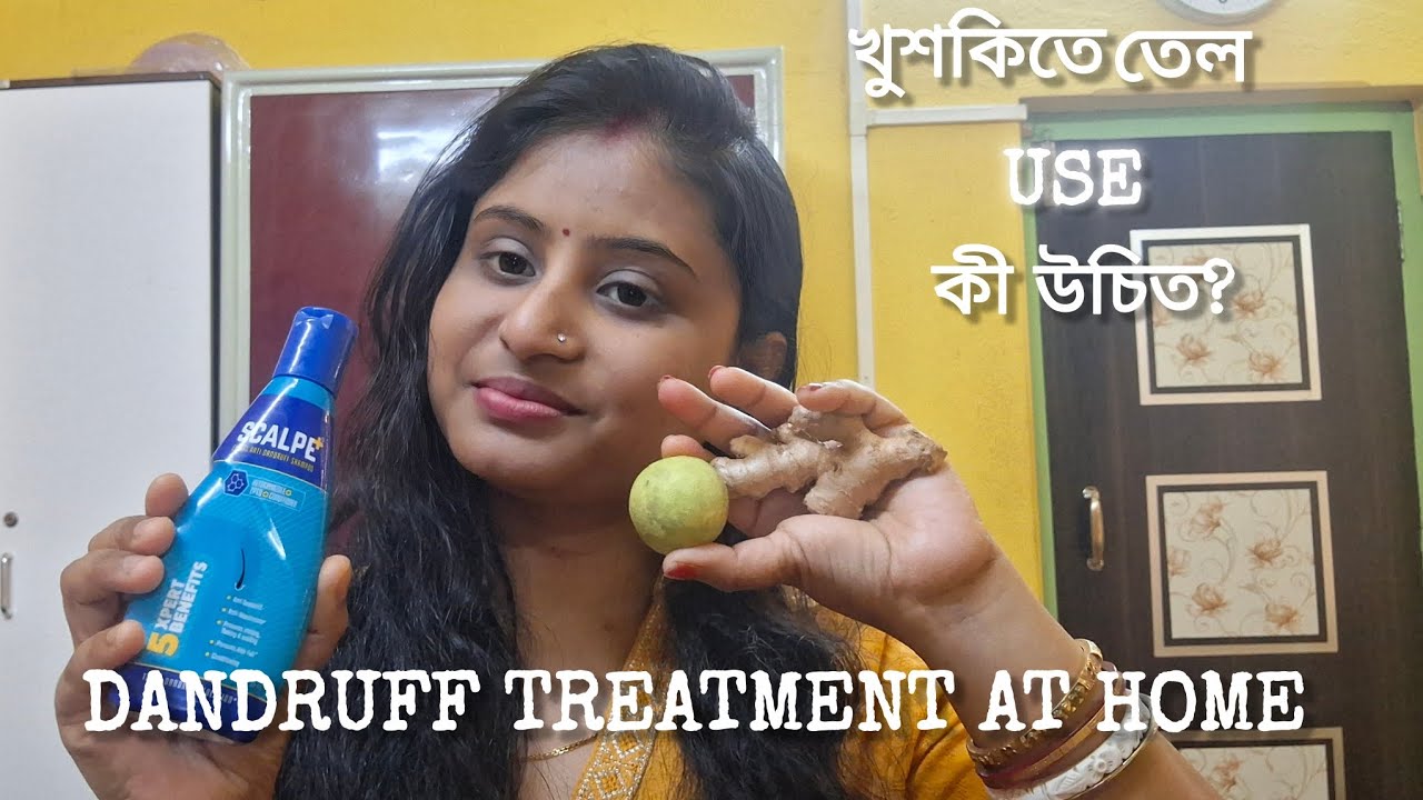 Dandruff treatment at home / খুশকি কীভাবে দূর করবেন ||salaution  