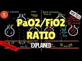 Pao2fio2 ratio in respiratory failure explained
