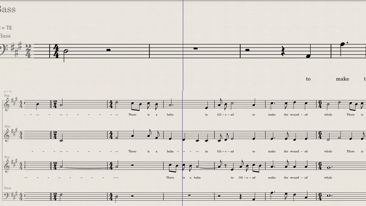 Balm in Gilead - William L. Dawson - Bass Emphasized