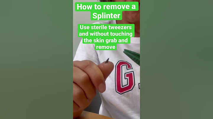Removing a splinter #shorts #splinter #firstaid