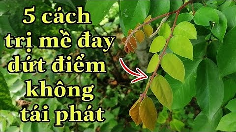 Cách Chữa MỀ ĐAY bằng lá khế Hiệu Quả - 5 Cách Trị Mề Đay Dứt Điểm Ko Tái Phát