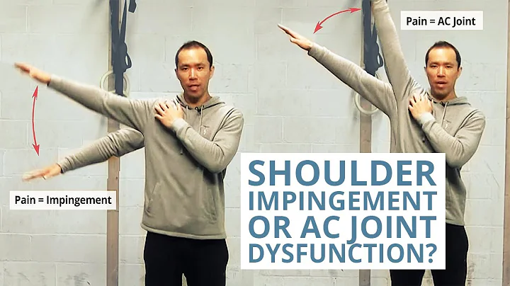 4 Tests to Differentiate Shoulder Impingement and AC Joint Dysfunction - DayDayNews