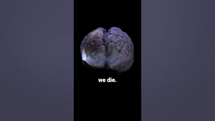 Your Brain Still Works After Death 😱 Doctor Reacts