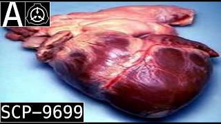 SCP-9699 "Universal Donor" [SCP Wikidot]