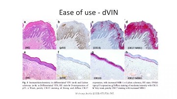 Multiplex immunostaining - Is it ready for clinical practice?