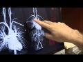 LabTV Profile: Peter Grayson, M.D., M.Sc