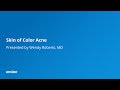 Skin of Color and Acne by Wendy Roberts, MD