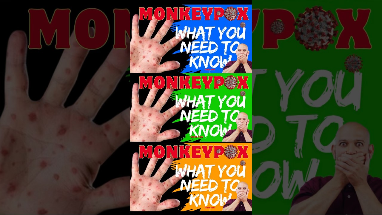 Protect Yourself from Monkeypox: Essential Tips 