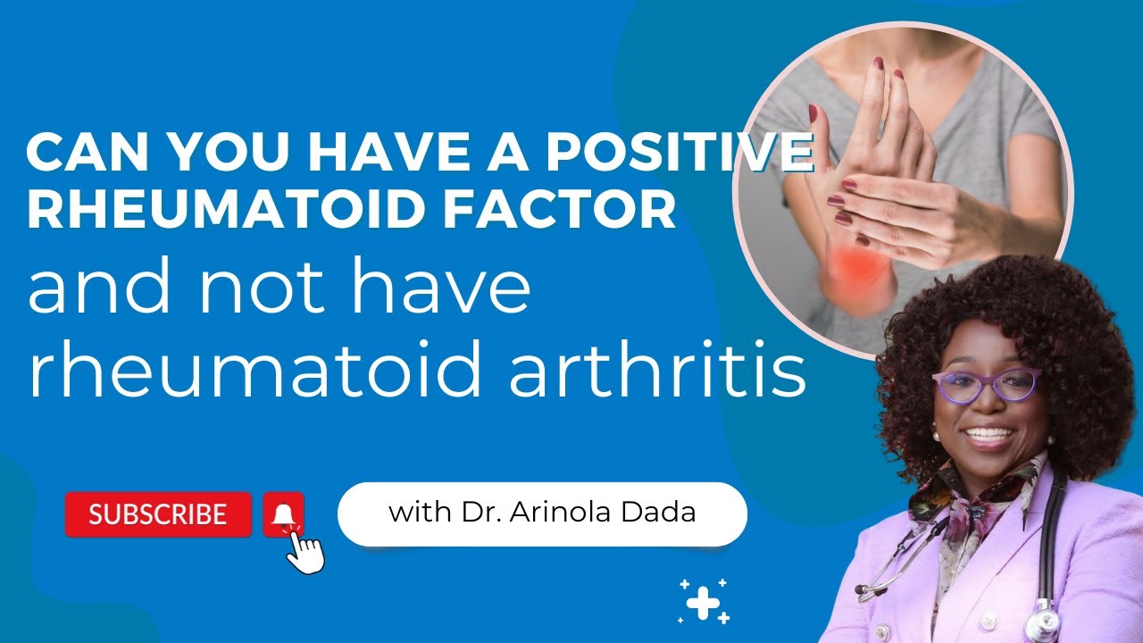 Can You Have A Positive Rheumatoid Factor And Not Have Rheumatoid Arthritis
