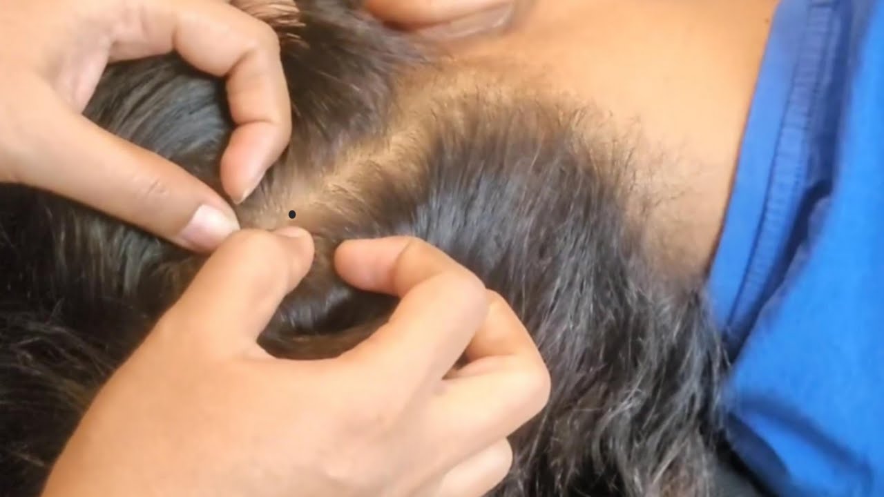 Ultimate Scalp Check Tingles & Hair Plucking Experience