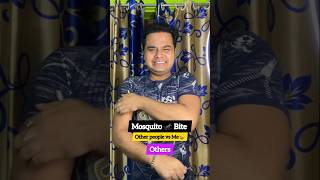 Love Bite Mosquito Bite    