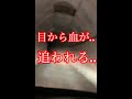 【危険】失神寸前！目から血が..助けて...（Part6）
