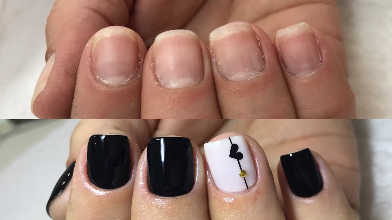 CUTILAGEM DAS MÃOS (TRANSFORMAÇÃO)