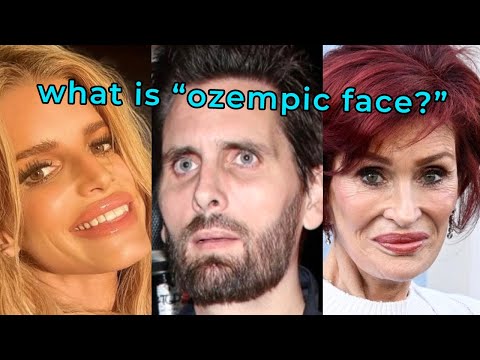 Celebrities Are Suffering From "Ozempic Face"