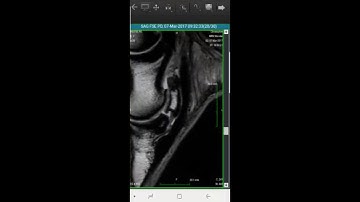DICOM Viewer Fundamentals
