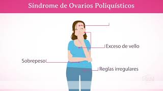 SOP con PCOS® NIAM  Ayuda NATURAL para los SÍNTOMAS del Síndrome de Ovarios Poliquísticos