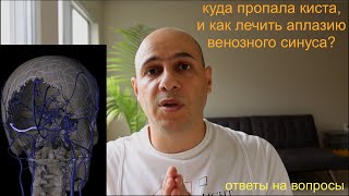 Куда делаcь киста и как жить без венозного синуса?